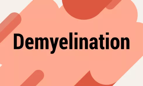 demyelinationpng