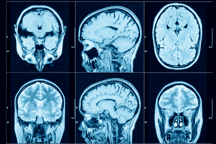  Multiple Sclerosis about us