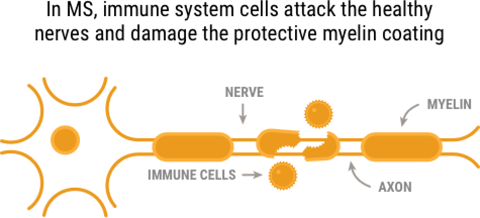immune-cells-graphic-0@2x-RRMS