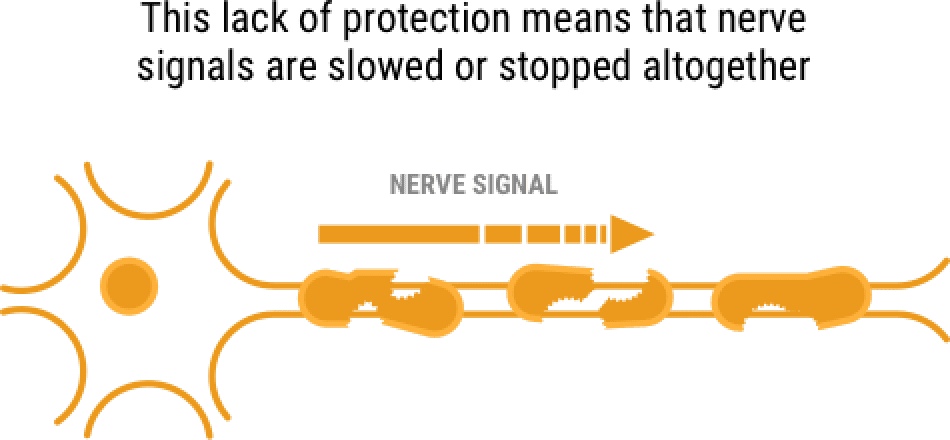 nerve-signal-graphic