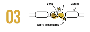 threepushbackmyelin