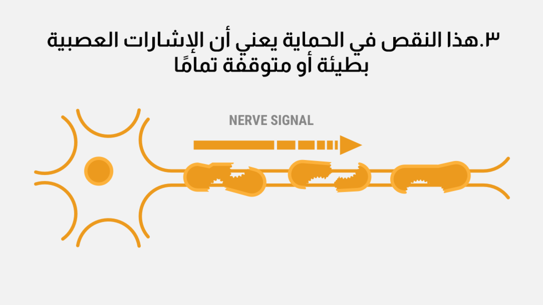 nerve-signal-graphicar